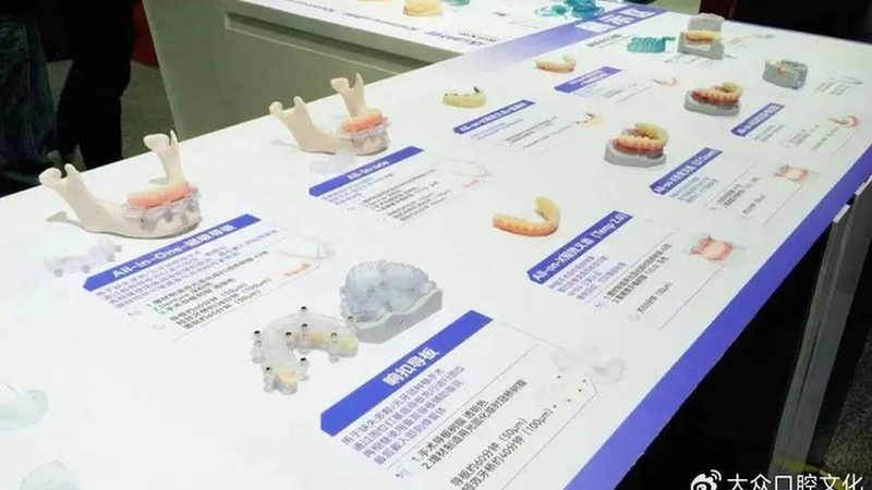 种植牙代理加盟，你需要了解的五大关键点**